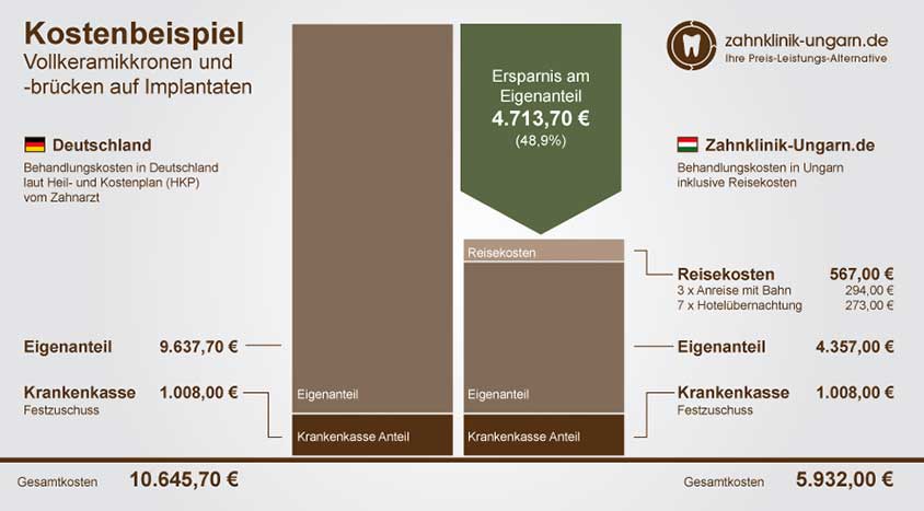 Kosten einer Zahnbehandlung mit Implantaten, Vollkeramikkronen und Brücken, Schaubild mit Kostenvergleich Ungarn und Deutschland