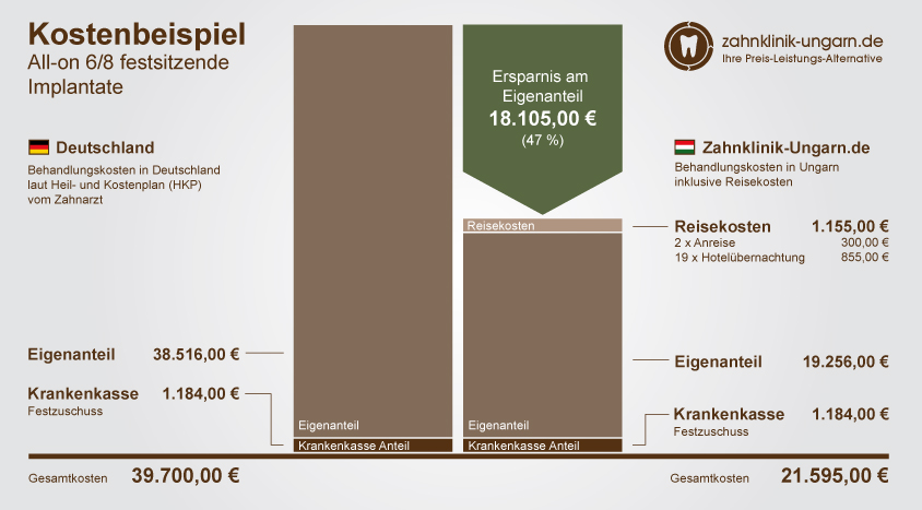 Kosten für All-on 6/8 festsitzende Implantate, Schaubild mit Kostenvergleich Ungarn und Deutschland