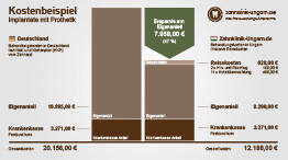 Kosten einer Zahnbehandlung mit Implantaten mit Prothetik, Schaubild mit Kostenvergleich Ungarn und Deutschland