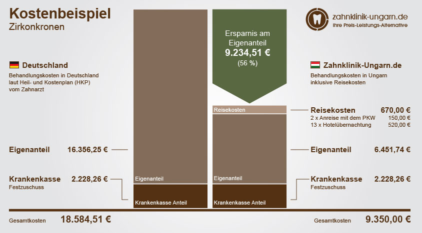 Kosten einer Zahnbehandlung mit Zirkon Vollkeramikkronen, Schaubild mit Kostenvergleich Ungarn und Deutschland