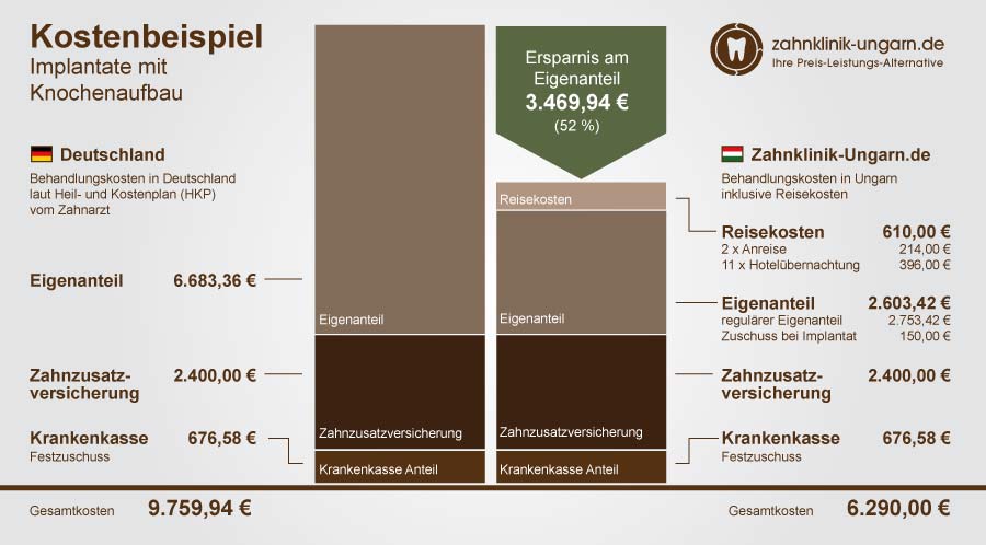 Kosten für Implantate mit Knochenaufbau Schaubild mit Kostenvergleich Ungarn und Deutschland