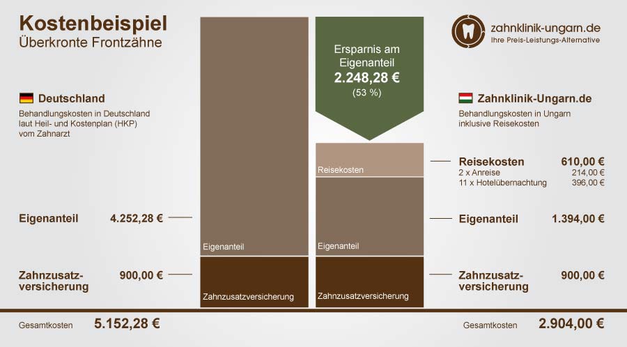 Kosten für überkronte Zähne im Frontbereich Schaubild mit Kostenvergleich Ungarn und Deutschland