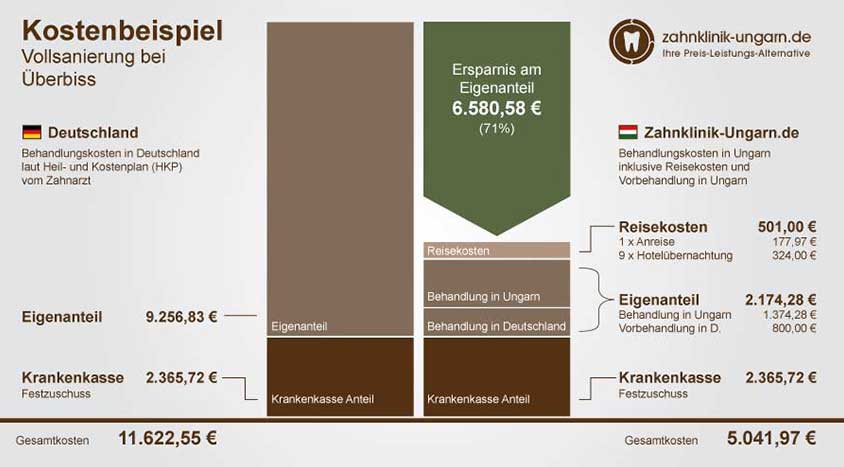 Preisvergleich Zahn-Vollsanierung bei Überbiss, Schaubild der Kosten in Ungarn und Deutschland