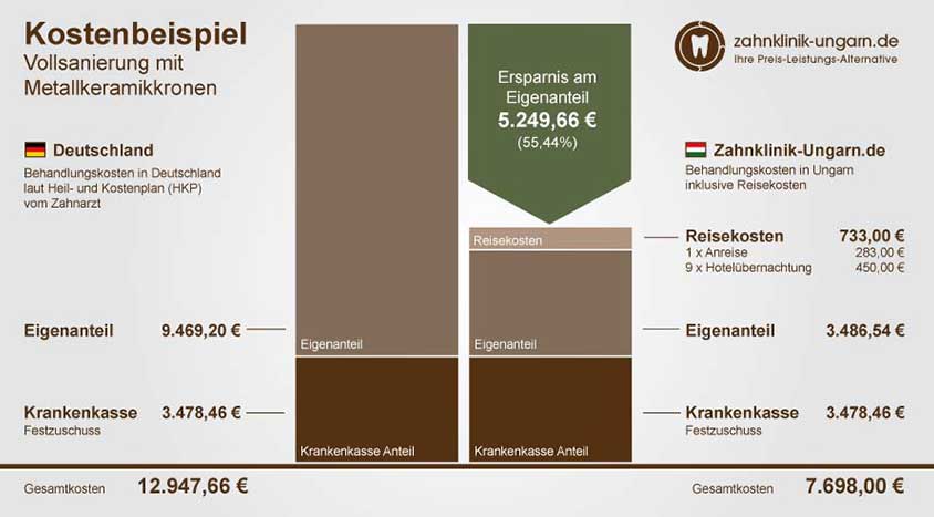 Preisvergleich Zahn-Vollsanierung mit Metallkeramikkronen, Schaubild der Kosten in Ungarn und Deutschland