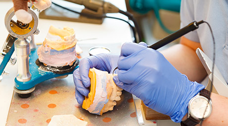 Herstellung einer Zahnprothese im Zahnlabor